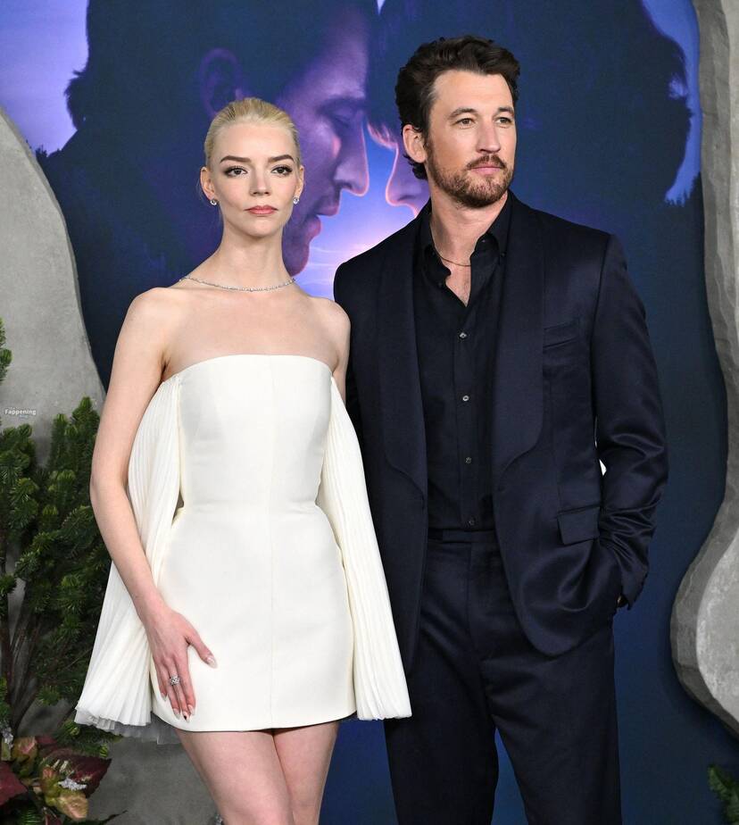 Anya Taylor-Joy Sexy Legs 1